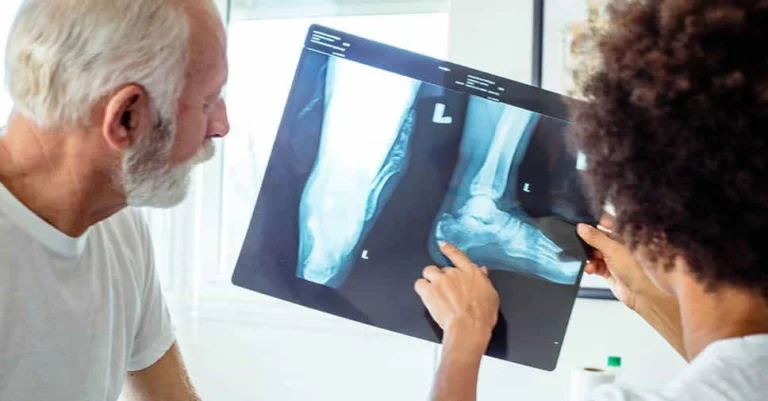 Osteoporose na Terceira Idade. Idoso observa radiografia com profissional de saúde, ilustrando cuidados com a osteoporose na terceira idade.