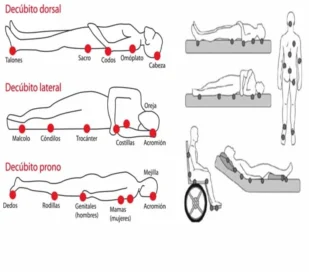 Diagrama de zonas de pressão