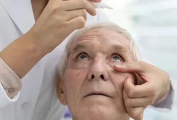 Profissional de saúde a aplicar gotas no ouvido de um idoso, ilustrando cuidados pessoais e higiene auditiva em ambiente geriátrico.